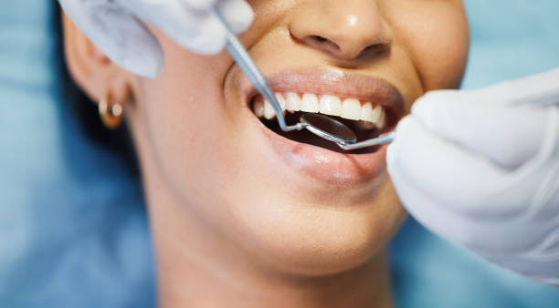 Emergency Dental Filling Replacement in MS